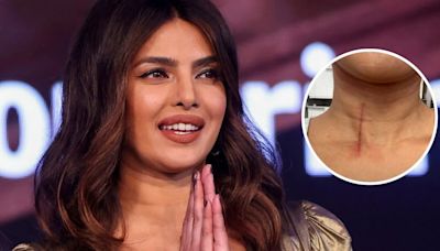 Priyanka Chopra se hirió la garganta mientras grababa una película: “Son los riesgos del trabajo”