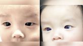 Infant's dark-brown eyes suddenly turn indigo blue after COVID-19 antiviral treatment. But why?