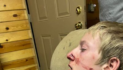 Arizona teen escapes bear attack with nasty scratches