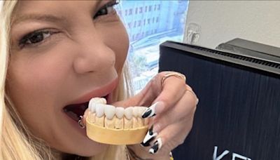 Tori Spelling got veneers after letting teeth turn to ‘s***’ in her 40s