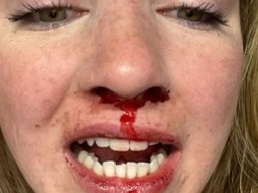 Woman 'terrified' to return to downtown area after 'homophobic' attack by group of men in Halifax, Canada