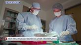 2 your health: new technology benefits liver transplants