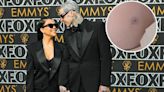 Kourtney Kardashian Reveals Stomach Scar From Emergency Fetal Surgery: I’m a ‘Fragile Little Egg’