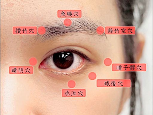 動眼神經麻痺 針灸、中藥加速痊癒 - 自由健康網