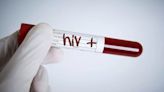 40 Million People Suffered From HIV Across The Globe In 2023, Says U.N. Report