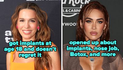 21 Famous People Who Confirmed What Cosmetic Surgeries Or Procedures They've Gotten, And I Wasn't Expecting Some Of These