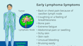 What Is Lymphoma, and Is It Serious?
