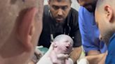 Baby in Gaza saved from womb of mother killed in Israeli strike