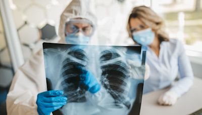 Air pollution exposure during childhood may affect lung health later