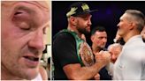 Tyson Fury's cutman provides update on eye injury that postponed Oleksandr Usyk fight