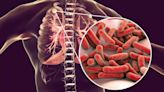 Tuberculosis: Symptoms, Causes, Prevention About The Disease