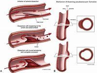 Image courtesy of mayoclinicproceedings.org