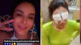 Jasmin Bhasin Gets Eye Patched Removed After Eye Injury: 'Finally Out Of Danger'