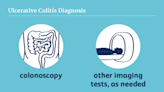 How to Get an Ulcerative Colitis Diagnosis