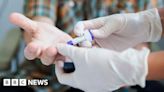 Diabetes: Billions spent treating preventable complications, says study