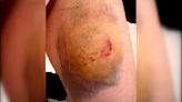 Una agente de la policía de Picassent, víctima del mordisco en la pierna de un detenido fuera de sí