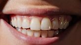 First human trials start in bid to regrow missing teeth