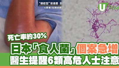 日本「食人菌」個案急增 醫生提醒6類高危人士注意 | U Travel 旅遊資訊網站