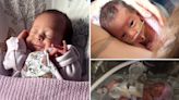 My baby was shockingly born inside-out: ‘I didn’t want to see it’