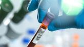 Blood test for cancer could detect disease seven years before diagnosis