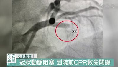 熱血揮棒一不小心 當場暈倒急送醫