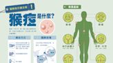 台灣出現首例女性猴痘個案！新北9旬婦輕症 匡9人採檢均陰性