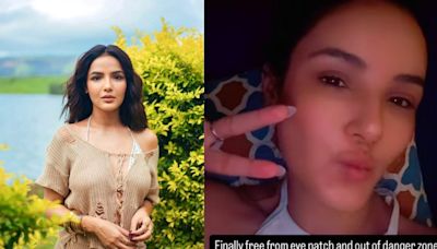 Jasmin Bhasin Recovers From Eye Injury, Thanks Doctors: ‘Finally Free From…’ - News18