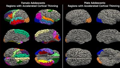 Novo estudo mostra que o lockdown da pandemia acelerou o envelhecimento cerebral das adolescentes em até 4 anos; entenda