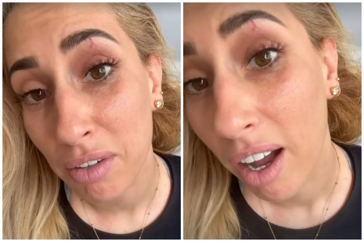 Stacey Solomon reveals she has accidentally given herself a black eye with latest DIY endeavour