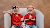 Únicas gêmeas do mundo com síndrome da velhice precoce completam 3 anos: 'Celebrando evoluções e conquistas'
