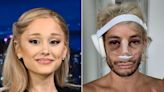 Ariana Grande Supports Brother Frankie’s Nose Job: ‘Perfect in All Ways, Always!!!!’