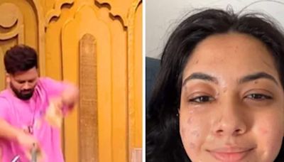 Actress Reem Shaikh Suffers Burns While Shooting For Reality Show Laughter Chefs - News18