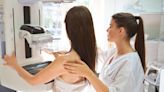 Mammograms Should Start at Age 40, New Guidelines Say
