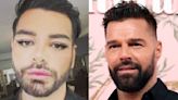 Hombre se somete a más de 30 cirugías para parecerse a Ricky Martin: por poco encuentra la muerte