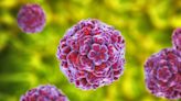 CDC Warns About Enterovirus D68, the Virus Linked to Paralysis in Kids