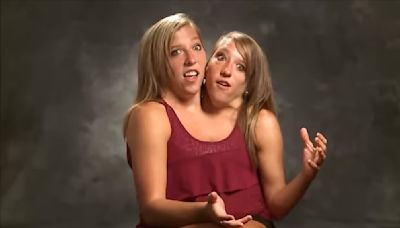 Conjoined Twin Abby Hensel Married in 2021