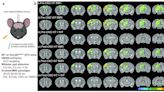 Study identifies primary cause of sensory hypersensitivity in a mouse model of autism spectrum disorder