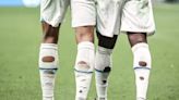 Why Footballers Have Holes In Their Socks - News18