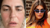 Influencer Katie Sturno 'woke up with Bell’s palsy' — what are the warning signs?