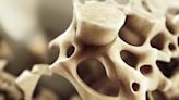 Vitamina que reduce el riesgo de osteoporosis
