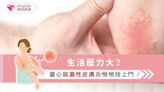 生活壓力大？當心脂漏性皮膚炎悄悄找上門！|健康-KingNet國家網路醫藥