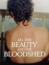 Tutta la bellezza e il dolore - All the Beauty and the Bloodshed