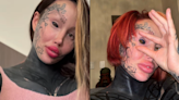 OnlyFans model who is 'addicted to plastic surgery' locked out of her account after latest procedure