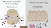 Research shows linked biological pathways driving skin inflammation