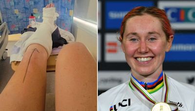 Olympic Cyclist to Miss Paris 2024 After Tripping on Backyard Step and Breaking Leg: ‘What the Heck’