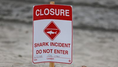4 Texas beachgoers attacked by 6-feet long shark on Fourth of July