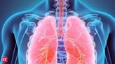 'Unusual' form of cell death underlies lung damage in Covid patients, finds study