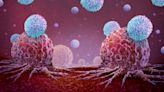 Inmunoterapia celular con linfocitos infiltrantes de tumor: ya podemos despertar al sistema inmunitario para que aniquile el cáncer