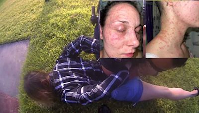 HORRIFIC IMAGES: Houston area woman claims officers held her face in fire ants, according to lawsuit