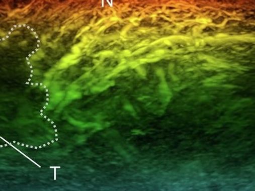 New miniature scanner could revolutionise diagnosis of diseases like cancer, diabetes and arthritis